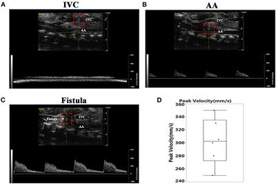 Volume Overload Initiates an Immune Response in the Right Ventricle at the Neonatal Stage